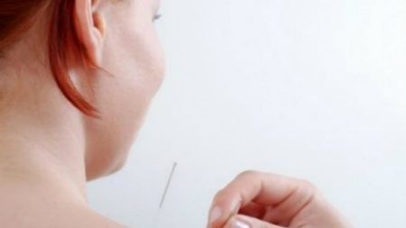 Acupuntura: medicina física para a dor e o estresse