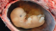 Nasce na Suécia o primeiro bebê de trasplante de útero
