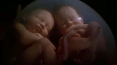 Gêmeos começam a interagir já nas 14 semanas de gravidez