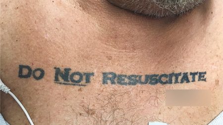 Médicos enfrentam dilema ético ao descobrirem tatuagem “Não Ressuscitar” em paciente