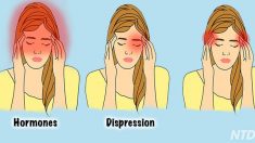 Conheça os diferentes tipos de dores de cabeça e suas causas mais comuns