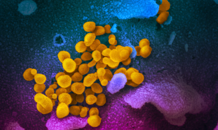 Esta imagem de microscópio eletrônico de varredura, divulgada em 13 de fevereiro de 2020, mostra SARS-CoV-2 (amarelo), também conhecido como vírus CCP, o vírus que causa COVID-19, isolado de células em um paciente nos EUA, azul / rosa em cor, cultivada em laboratório (Cortesia de NIAID-RML)
