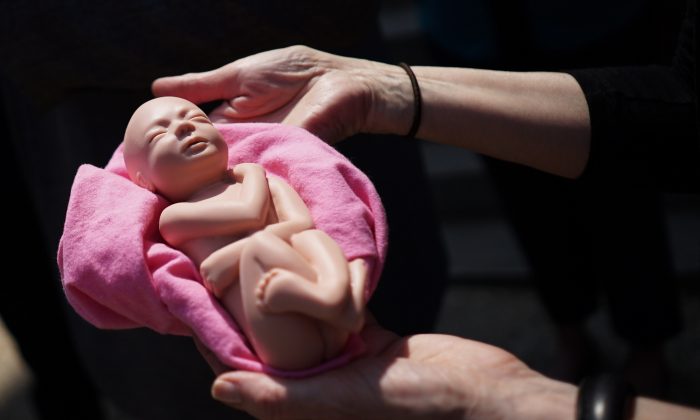 Um ativista pró-vida mostra uma modelo de um bebê ainda não nascido (Mandel Ngan / Archive / AFP / Getty Images)
