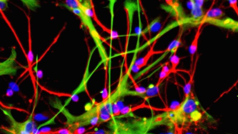 Os neurônios (vermelho) e astrócitos (verde), que podem ser produzidos a partir de células-tronco neurais, são vistos nesta foto de arquivo sem data, divulgada pelo Institute for Stem Cell Research em 16 de agosto, 2005 (Institute for Stem Cell Research via Getty Images)