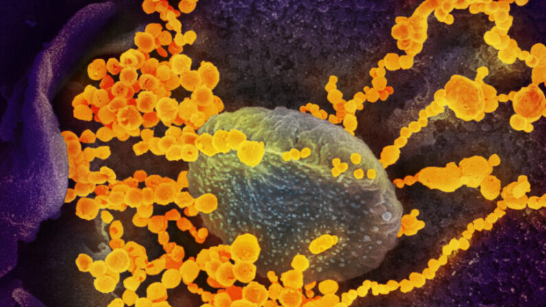 Uma imagem de microscópio eletrônico mostra SARS-CoV-2 (objetos redondos de ouro), que causa o COVID-19, emergindo de células cultivadas. (NIAID via Epoch Times)