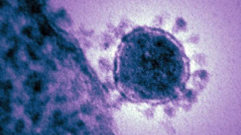 Uma micrografia eletrônica de MERS-CoV. (EUA NIAID)