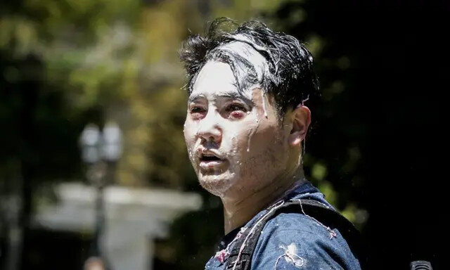 Andy Ngo, um jornalista de Portland, Oregon, é visto coberto por uma substância desconhecida depois que extremistas da Antifa o agrediram em Portland, Oregon, em 29 de junho de 2019. (Moriah Ratner/Getty Images)
