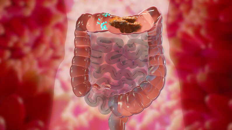 Ilustração 3D da anatomia do sistema digestivo humano, conceito de intestino, laxante, tratamento da constipação (ALIOUI MA/Shutterstock)