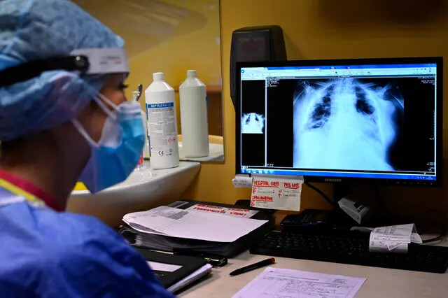 Uma enfermeira visualiza as radiografias pulmonares de um paciente com COVID-19 no hospital Casalpalocco, ao sul de Roma, Itália, em 13 de outubro de 2021. (Alberto Pizzoli/AFP via Getty Images)
