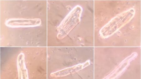 Vacinas de mRNA contra COVID formam proteína spike nas células do coração, mas causam anomalias diferentes: artigo de pesquisa