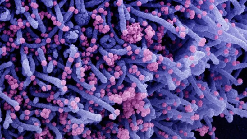 Micrografia eletrônica de varredura colorida de uma célula (roxa) infectada com uma cepa variante de partículas do vírus SARS-CoV-2 (rosa), isolada de uma amostra de paciente. (NIAID via The Epoch Times)