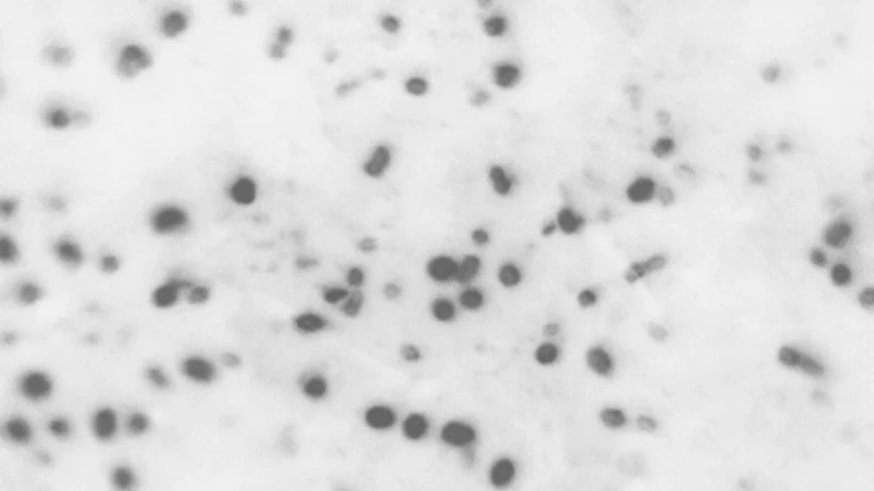 Esta foto de microscópio fornecida pelos Centros de Controle e Prevenção de Doenças dos EUA mostra a bactéria Haemophilus influenzae gram-negativa, uma das causas mais comuns de olho rosa em crianças. (William B. Cherry/CDC via AP)

