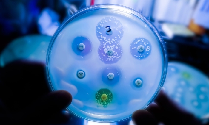 A resistência antimicrobiana (RAM) ocorre quando bactérias e fungos desenvolvem a capacidade de derrotar os medicamentos criados para matá-los, escreve Drew Ferguson. (Shutterstock)
