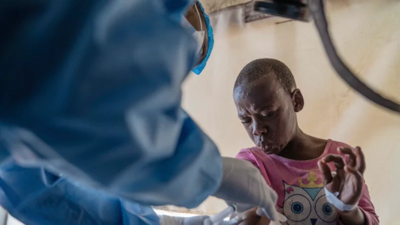 Um profissional de saúde atende um paciente com mpox, em um centro de tratamento em Munigi, leste do Congo, em 19 de agosto de 2024. AP Photo/Moses Sawasawa, Arquivo
