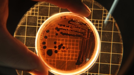 Bactéria resistente a vários antibióticos é detectada no Nordeste e representa risco mundial de saúde