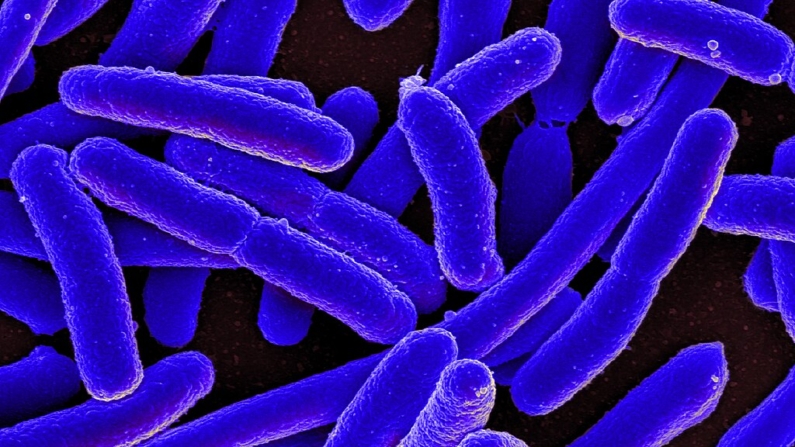 Micrografia eletrônica de varredura colorida de Escherichia coli, cultivada em cultura e aderida a uma lamínula em 2013 (Imagem:  NIAID)