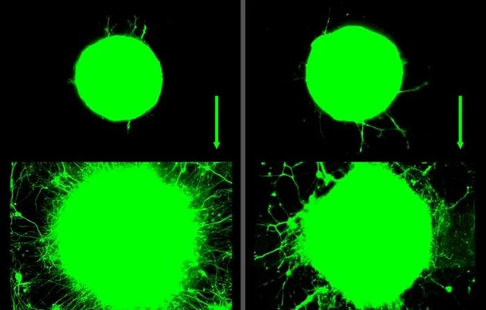 Os cientistas do MIT descobriram que o crescimento dos neurônios motores aumentou significativamente ao longo de 5 dias em resposta a sinais bioquímicos (esquerda) e mecânicos (direita) relacionados ao exercício. A bola verde representa um aglomerado de neurônios que crescem em longas caudas ou axônios. (Angel Bu)
