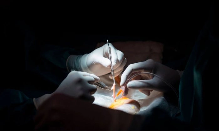 Médicos se preparam para um transplante de rim em uma foto de arquivo (Pierre-Philippe Marcou/AFP/Getty Images)
