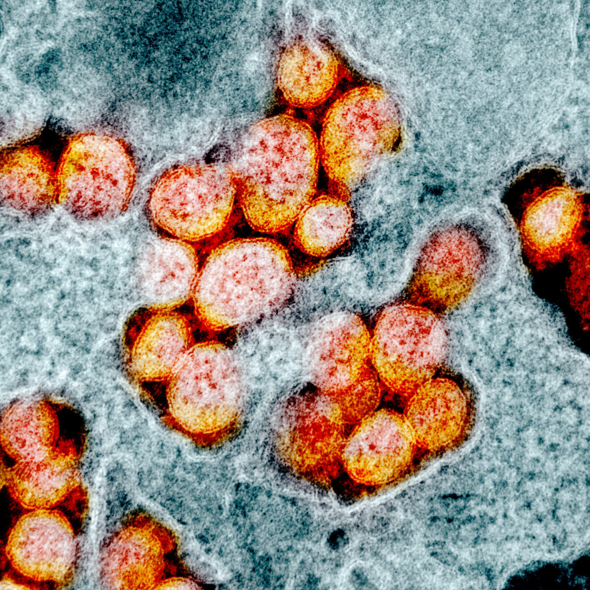 Fotomicrografia por transmissão de elétrons do vírus SARS-CoV-2, ao qual o Epoch Times se refere como vírus do PCC, isolado de um paciente (NIAID)